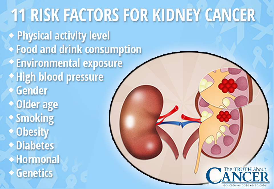Kidney Cancer Causes: 11 Factors Putting You at Risk