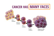 Cancer-has-many-faces