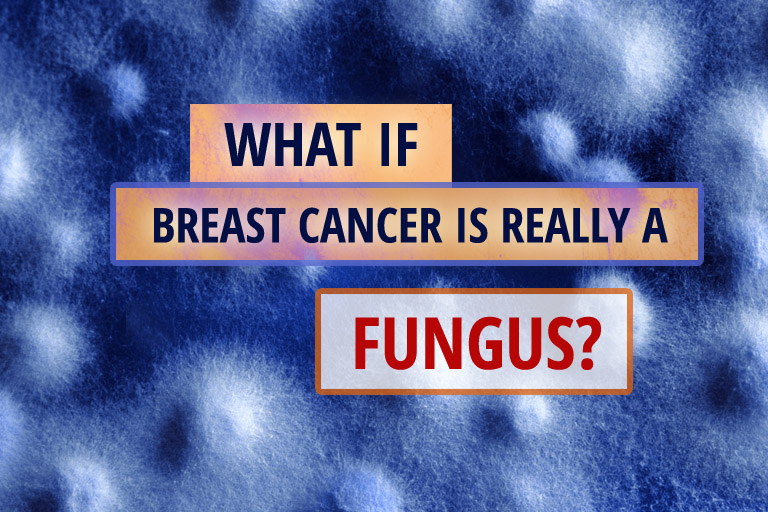What If Breast Cancer Is Really A Fungus?