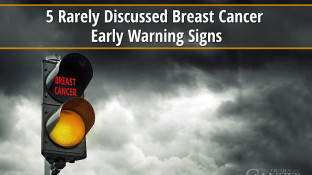 Breast Cancer Signs: 5 Rarely Discussed Early Warning Signs Breast Cancer Signs: 5 Rarely Discussed Early Warning Signs