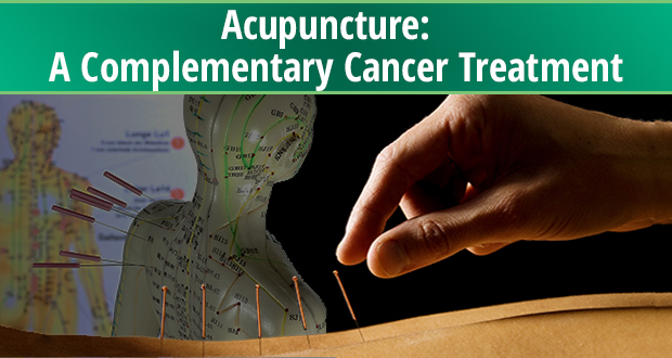 Acupuncture A Complementary Cancer Treatment