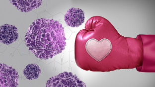 Tamoxifen Alternatives for Estrogen Dominant Breast Cancer Tamoxifen Alternatives for Estrogen Dominant Breast Cancer