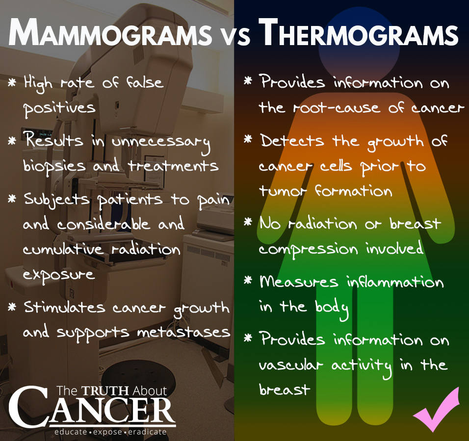 Mammograms-Thermograms-breast-cancer-test-comparison
