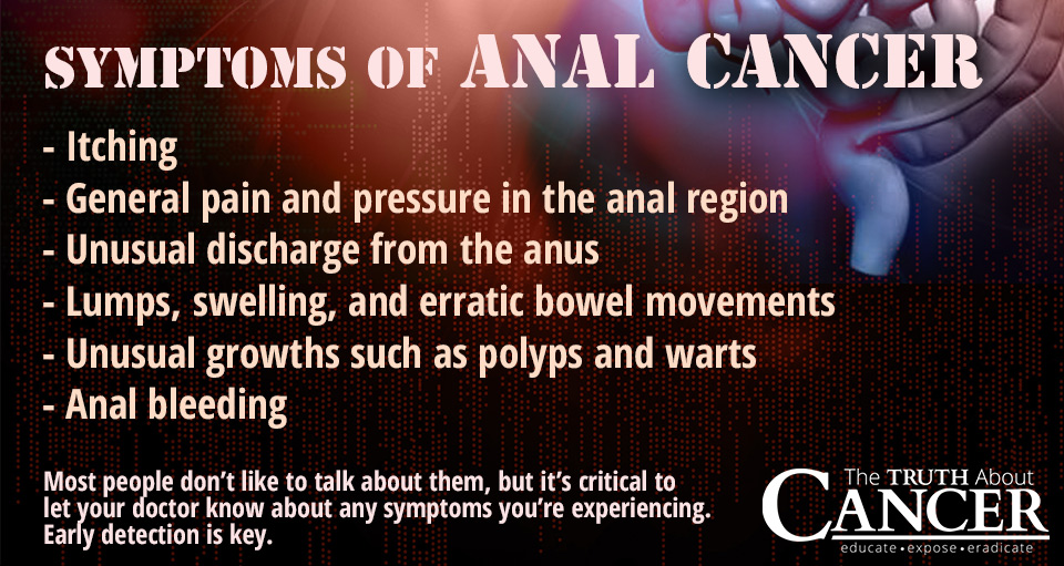 Anal Sex Symptoms - What Are Symptoms Of Anal Cancer - Hot porno