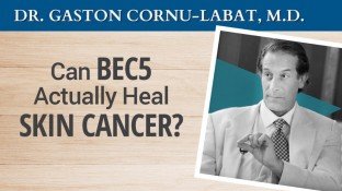 Can BEC5 Actually Heal Skin Cancer? (video) Can BEC5 Actually Heal Skin Cancer? (video)