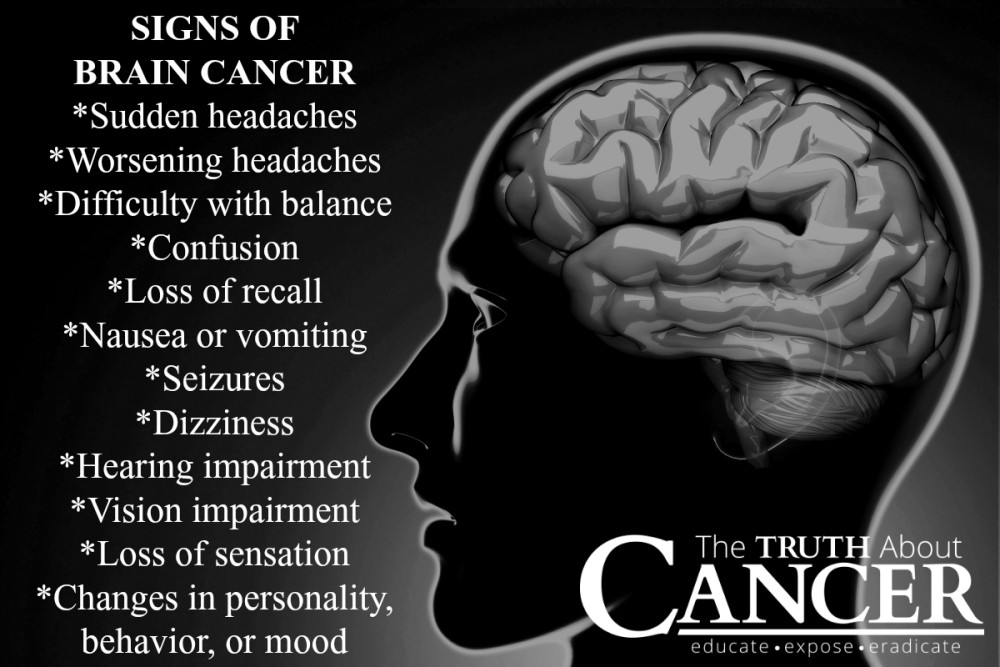 Causes And Symptoms Of Brain Cancer The Truth About Cancer