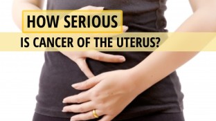 How Serious is Cancer of the Uterus? How Serious is Cancer of the Uterus?