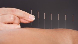 Acupuncture vs. Opioids: The Best Choice for Pain Relief Acupuncture vs. Opioids: The Best Choice for Pain Relief