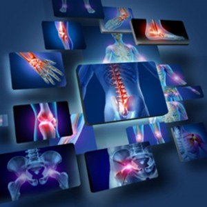 While people generally recognize inflammation in the joints, it can be a “silent trigger” in other parts of the body
